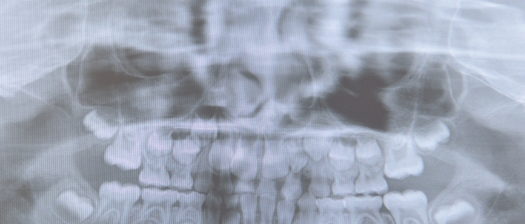 口腔機能を意識した検査